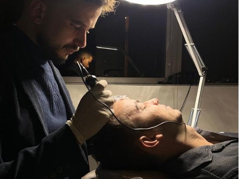 Dr. Vinicius Carneiro realizando o MMP capilar no couro cabeludo de um paciente, etapa do Protocolo LV Hair