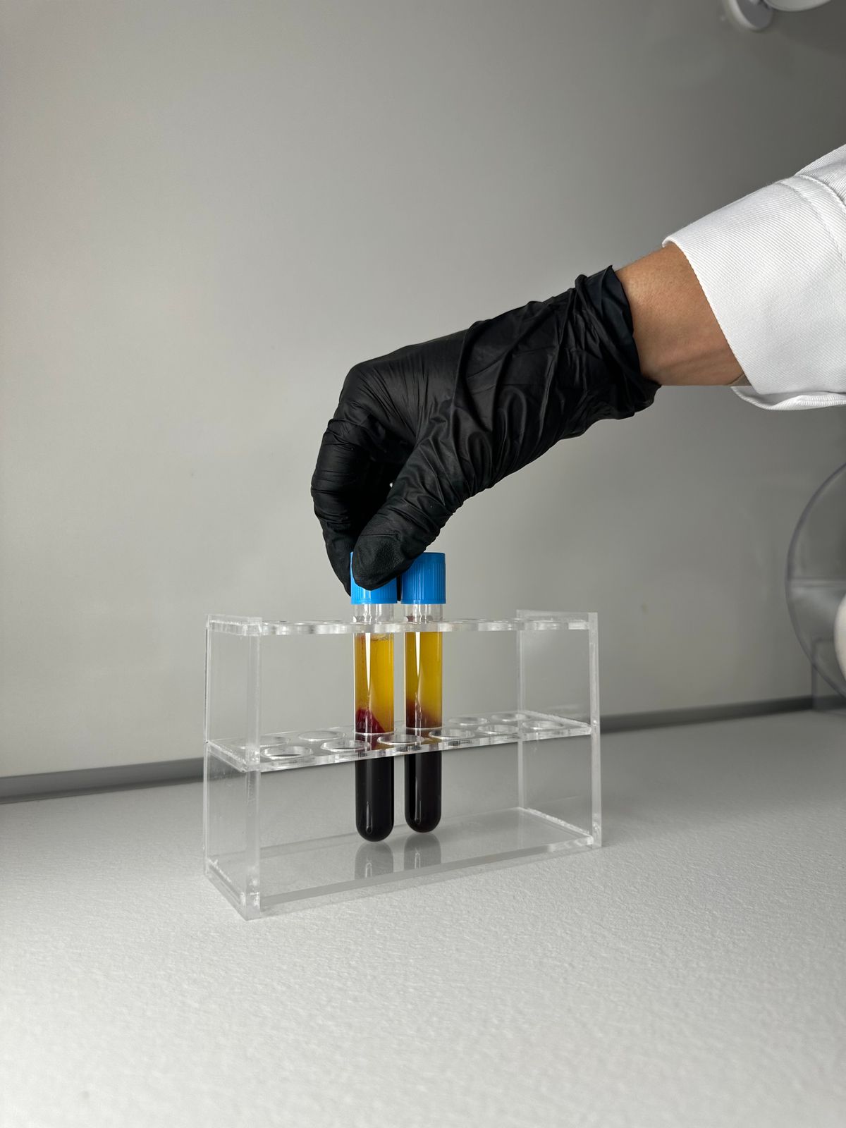 Tubos de plasma rico em plaquetas (PRP) separados por centrifugação