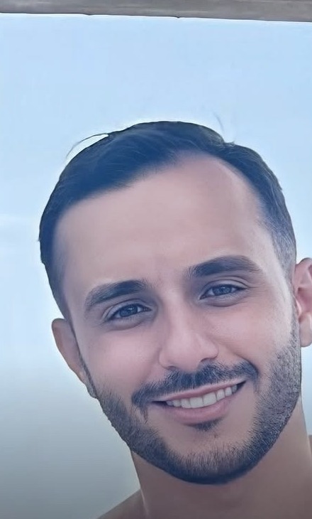 Depois do Protocolo LV Hair, paciente 2