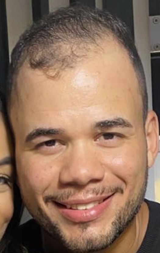 Antes do Protocolo LV Hair, paciente 3