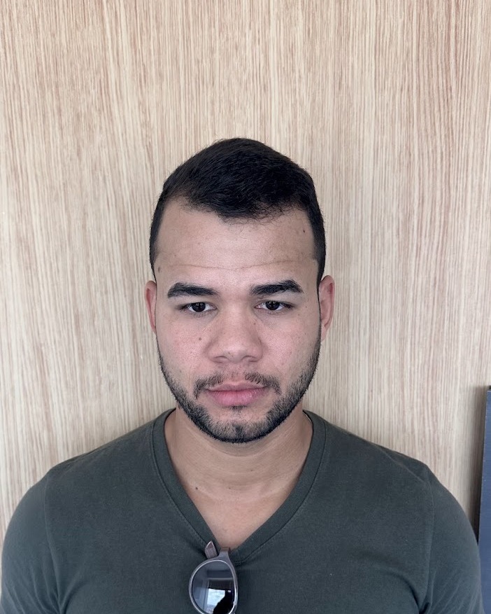 Depois do Protocolo LV Hair, paciente 3, outro registro