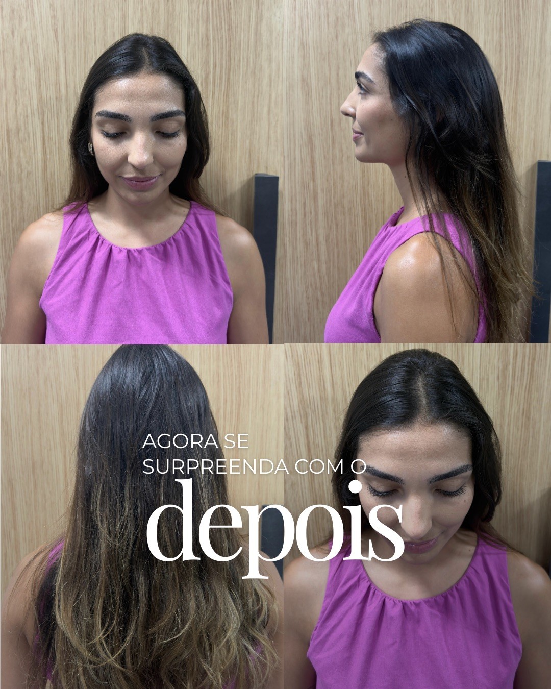 Depois do Protocolo LV Hair, paciente 6